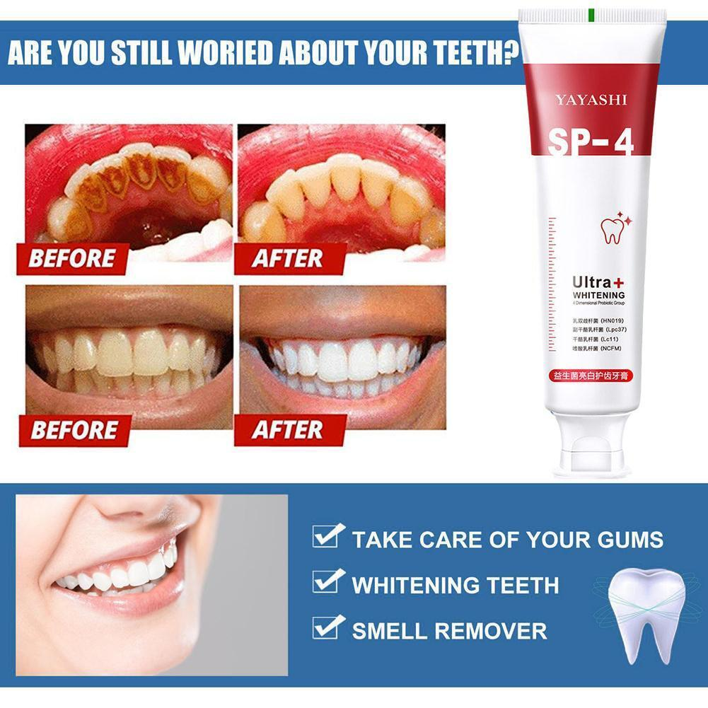 🔥Limited Time Sale 48% OFF🎉Probiotic Whitening Toothpaste