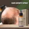 💥2023 New Hair Growth Spray - Fast Hair Growth - Prevent Hair Loss[🔥Buy 1 Get 1 Free🔥]