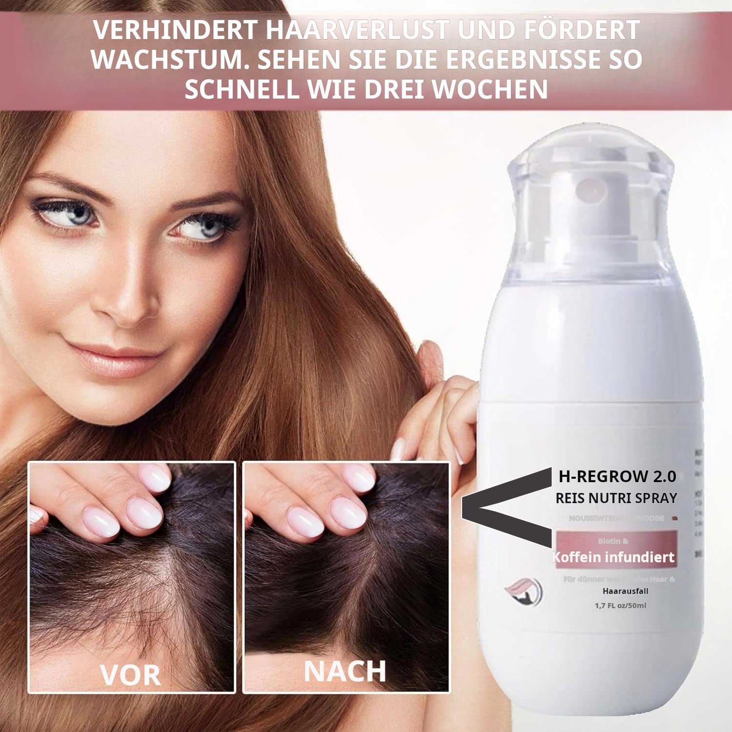 🔥Letzter Tag 50% RABATT- H-Regrow 2.0 - Reis-Nährspray für Haarwachstum