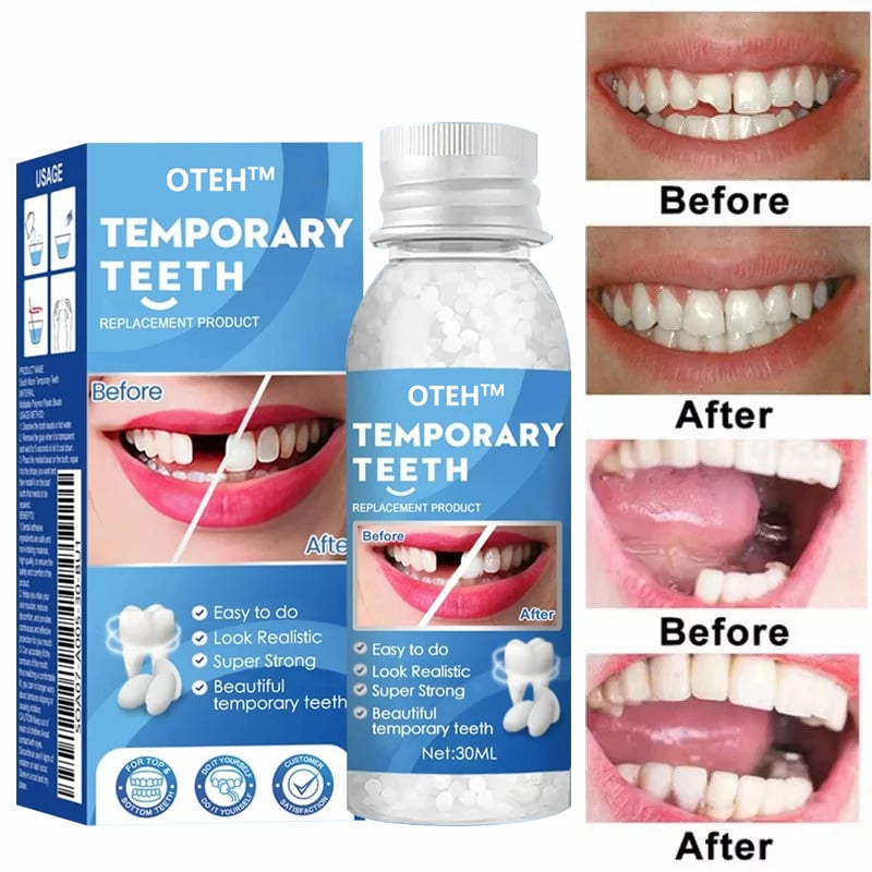 OTEH™ – The Ultimate Temporary Tooth Repair Solution for a Perfect Smile