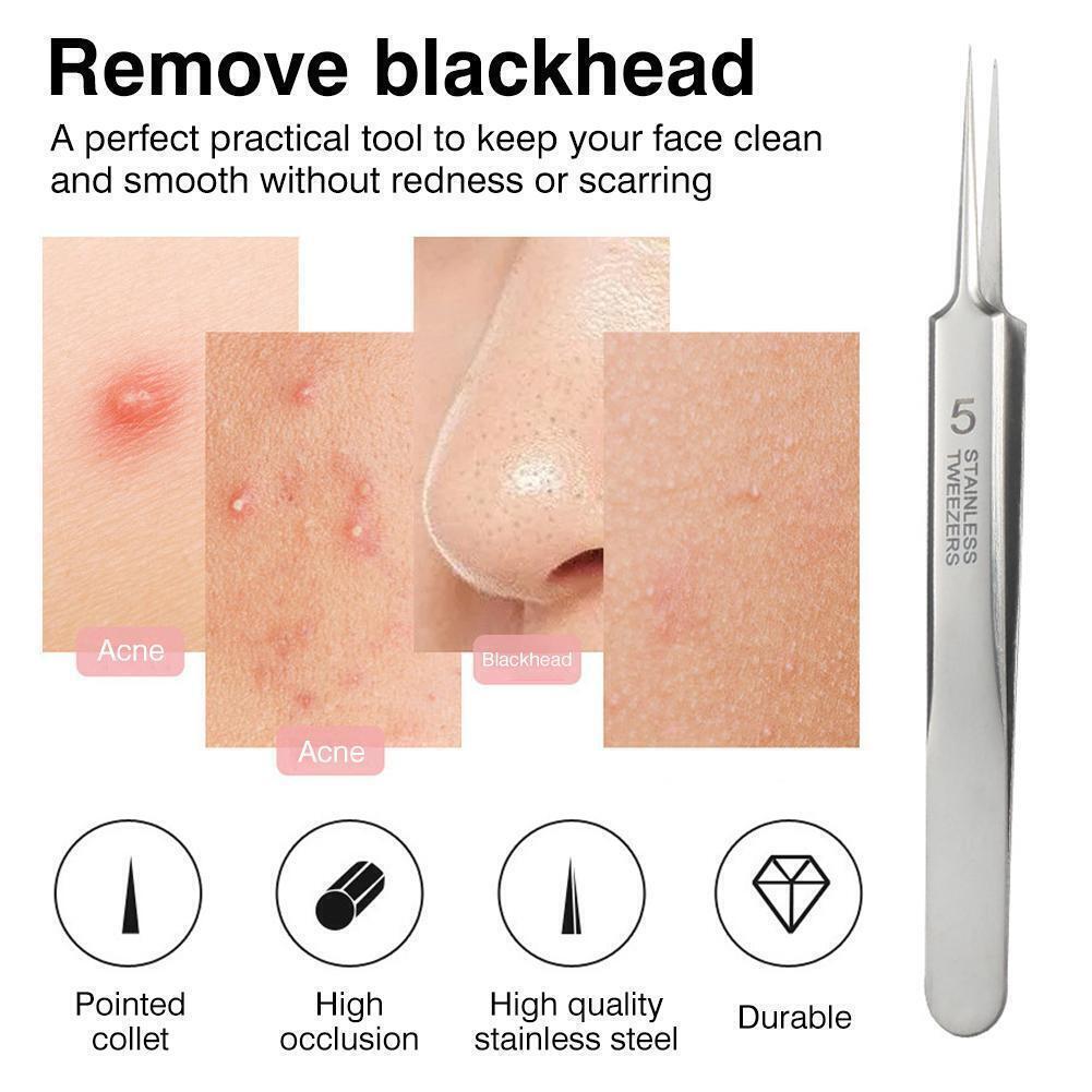 🔥Limited Time Sale 48% OFF🎉Acne Clip Tweezers Blackhead Clip(Buy 2 get 1 free)
