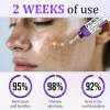 BENDCHARGE™ PigmentaX ProFade Anti-Hyperpigmentation Cream