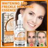 💥Daily Sales of 7200+🔥  2025 The Most Popular - Mature Women Whitening Skin Melanin Correcting Facial Serum