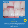 🔥Hot sale🔥INSTASMILE DENTAL REPAIR KIT [50 teeth can be repaired.]