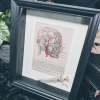 Lobotomy Shadowbox Display