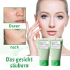 ✨(GRÜNE TOMATE) REINIGUNGSMITTEL FÜR TONMASKE