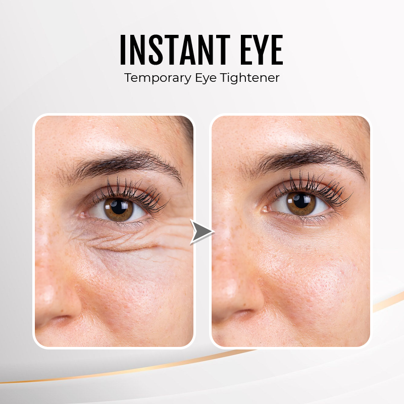 🔥Last Day Discount: 70% OFF - Upgraded Instant Wrinkle Eye Tightener cream