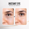 🔥Last Day Discount: 70% OFF - Upgraded Instant Wrinkle Eye Tightener cream