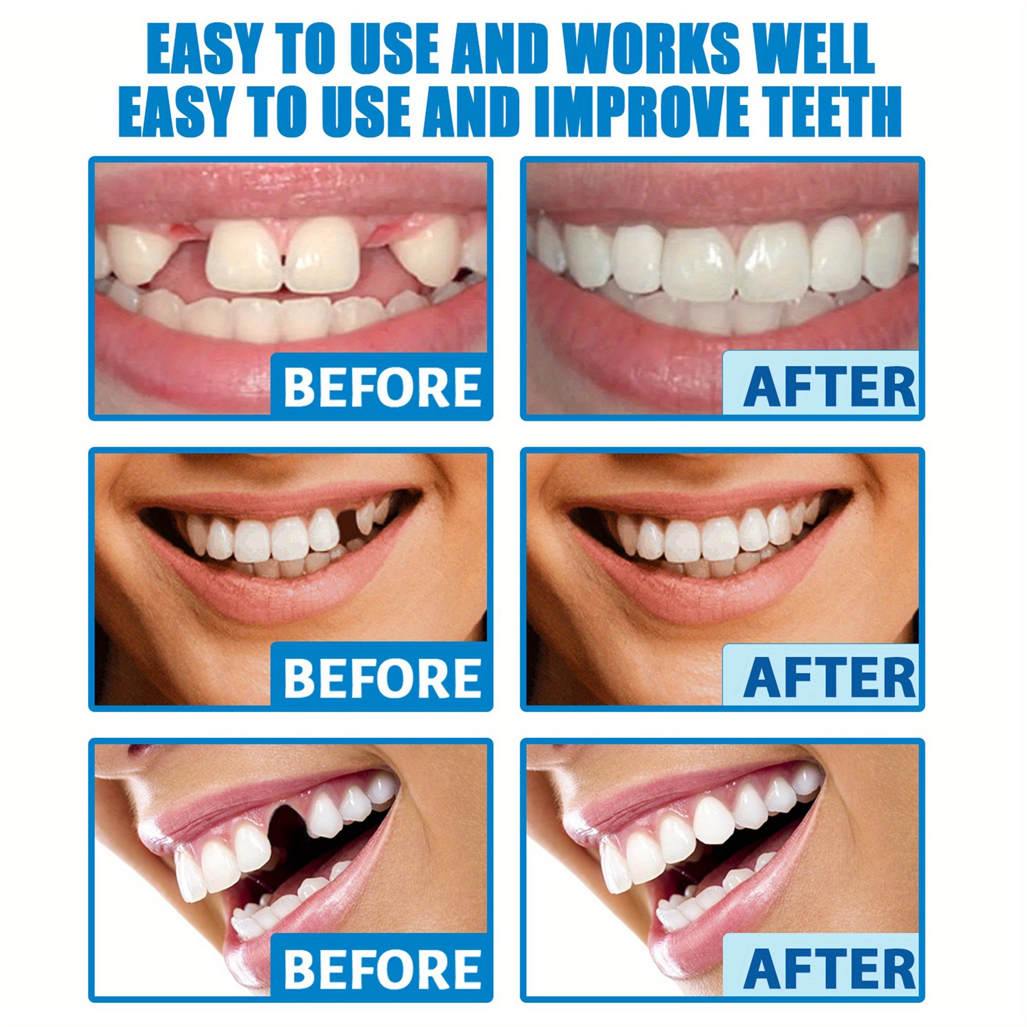 Clinclii™ Moldable False Teeth Restore Your Smile, Anytime. Anywhere