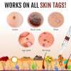 🔥Last Day Promotion 50% OFF🔥Tags & Moles Remover - Buy 2 Get 1 Free & Free Shipping