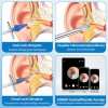 👂Kabellose endoskopische Ohrlöffel (Achtteiliges Set)