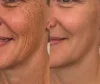 Dual Action Real Deep Collagen Sheets for both wrinkle smoothing and new or old scar fading