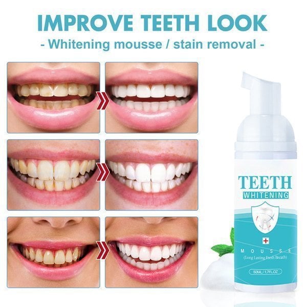 🔥SUMMER SALE 49% OFF -Teeth Whitening Mousse🔥（Buy 2 get 1 free)