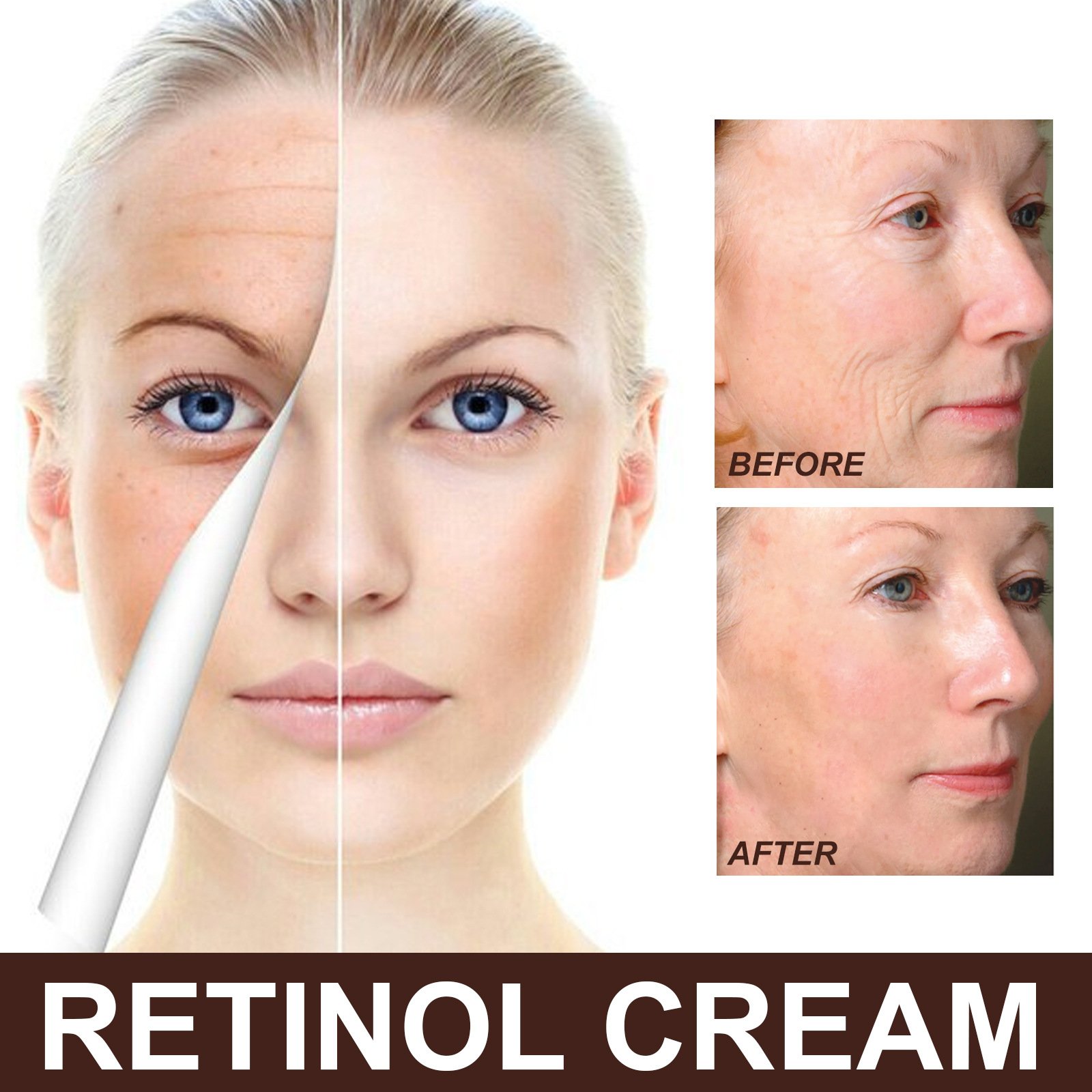 Last Day Promotion 75% OFF -🔥 Retinol Anti Aging Wrinkle Removal Skin Firming Cream🔥