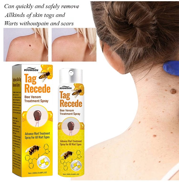🔥🔥🔥 2025 Bee Venom Wart Care Spray