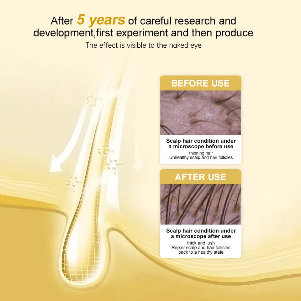 🔥LAST DAY 50% OFF 🔥PURC Hair Regrowth Treatment - Anti Hair Loss & Hair Growth