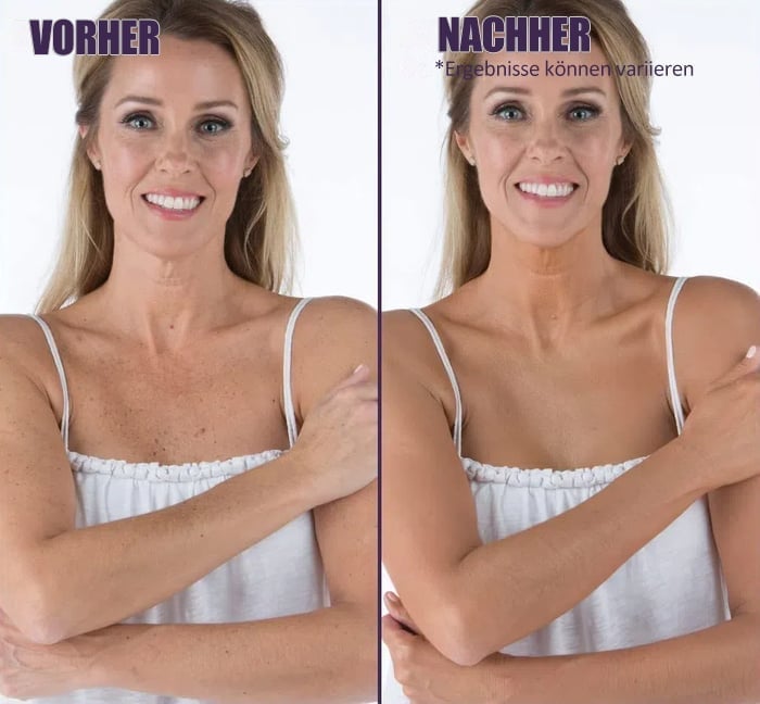 🎉All-in-one Feuchtigkeitscreme, Concealer & Deckkraft 💧✨ Leichtgewichtig und wasserdicht!