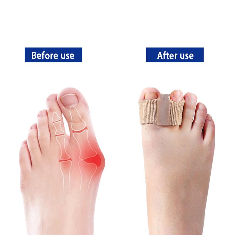 ⏰LAST DAY SALE 50% OFF💥Premium Elastic Toe Separators – Comfortable Pain Relief & Alignment