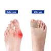 ⏰LAST DAY SALE 50% OFF💥Premium Elastic Toe Separators – Comfortable Pain Relief & Alignment