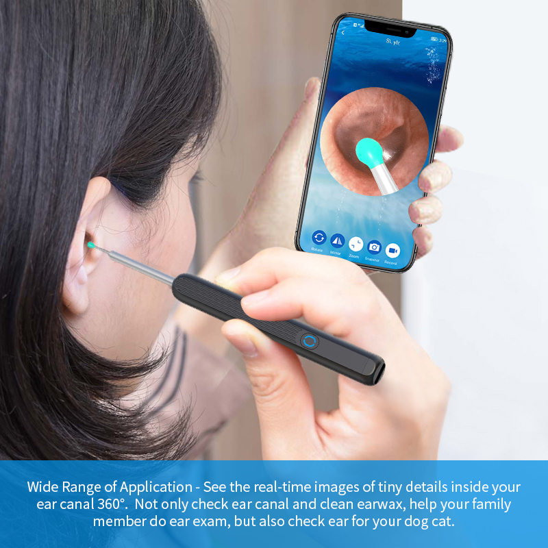 🔥Last Day Promotion 50% OFF🔥Wi-Fi visible Ear Wax Remover, USB 1080P HD load otoscope