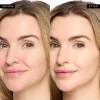 🎁TikTok Last Day Sale - 70% OFF🎉Colored Clay Undereye Corrector