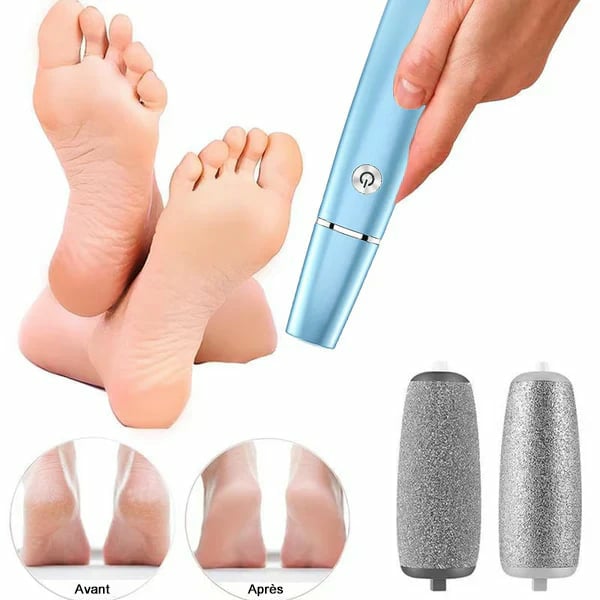 🔥Dernier jour -50 % de réduction - Éliminateur électrique de callosités pour les pieds
