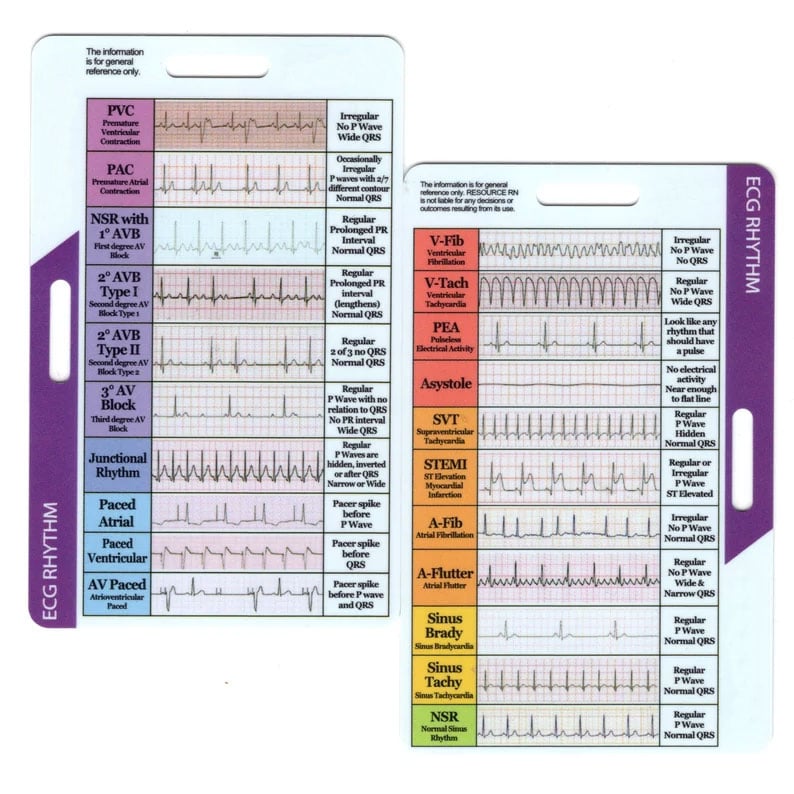 ECG/EKG Rhythm Pocket Card