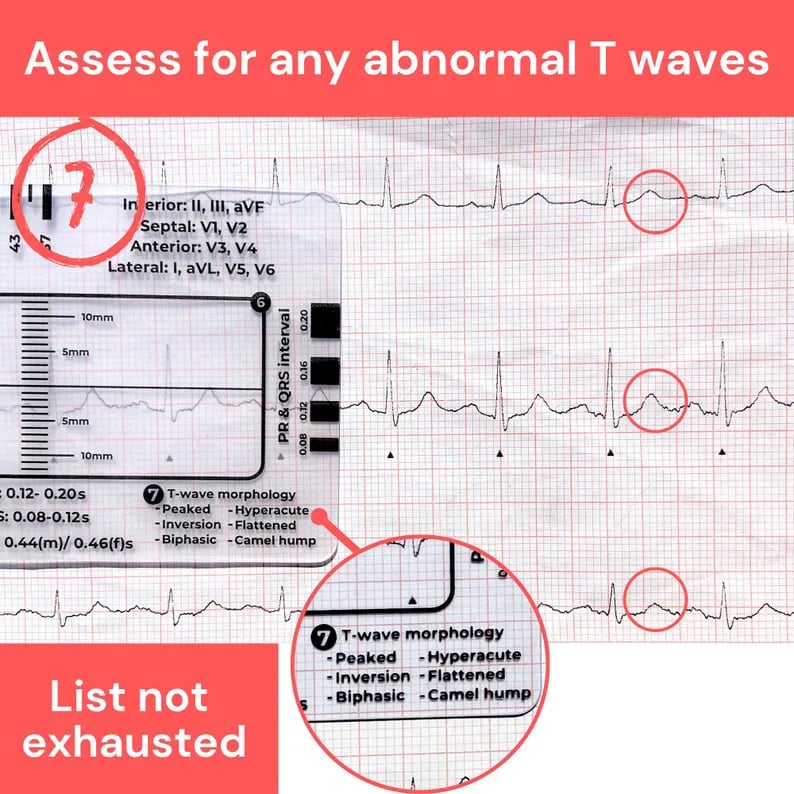 ECG 7 Step Ruler