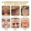 🔥Last Day Discount: 70% OFF - Upgraded Instant Wrinkle Eye Tightener cream