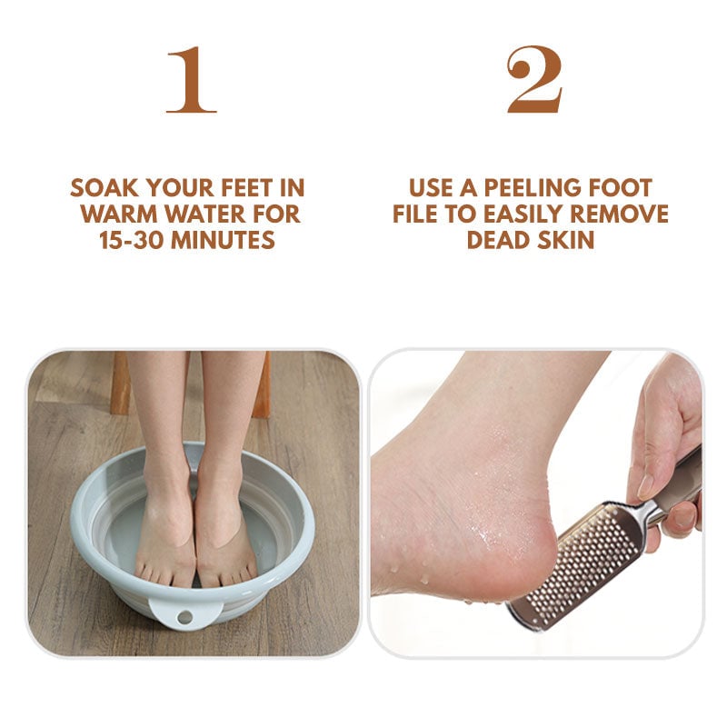 Exfoliating Dead Skin Remover Peeling Foot File