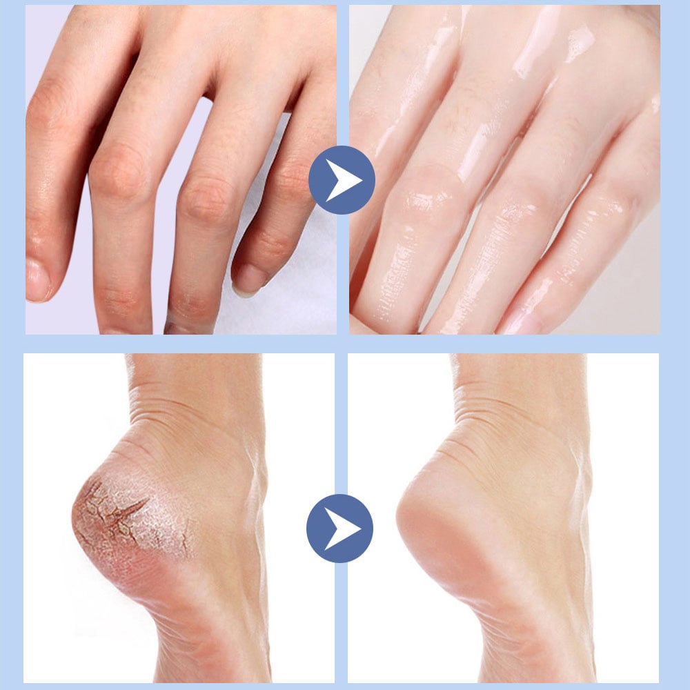💥LAST DAY SALE 50% OFF💥Foot Moisturising Stick