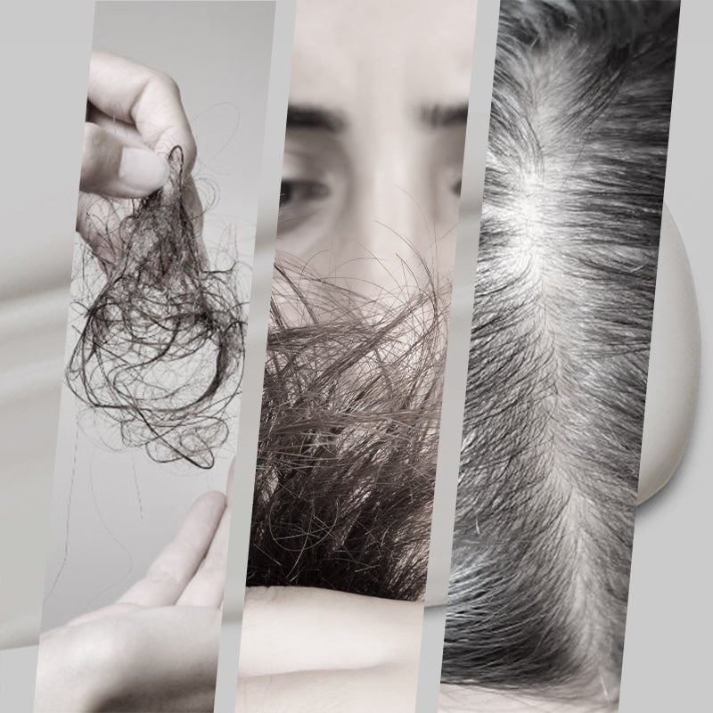 🔥Letzter Tag Verkauf 49% Rabatt🎁2-in-1 Natürliche Essenz Extrakt Silber Haarfärbemittel