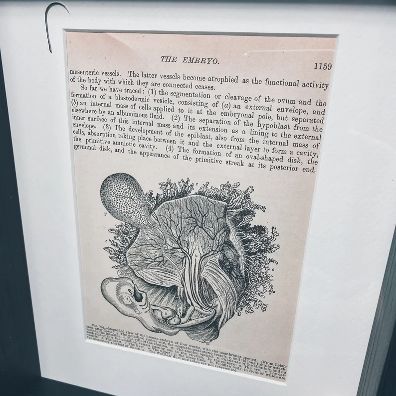 Lobotomy Shadowbox Display