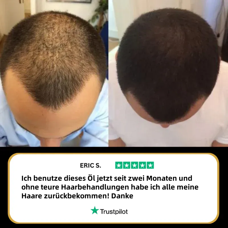 2025🎁Letzter Tag 49 % Rabatt🔥Natürliches Haarwuchsöl