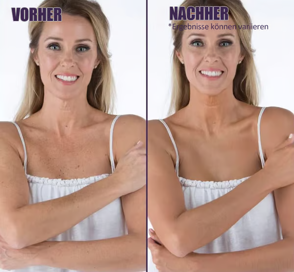 🔥LETZTER TAG 49 % RABATT🌟Körper-Concealer-Perfektionscreme – Feuchtigkeitsspendend, langanhaltend, leicht und wasserfest, 4 in 1💧✨
