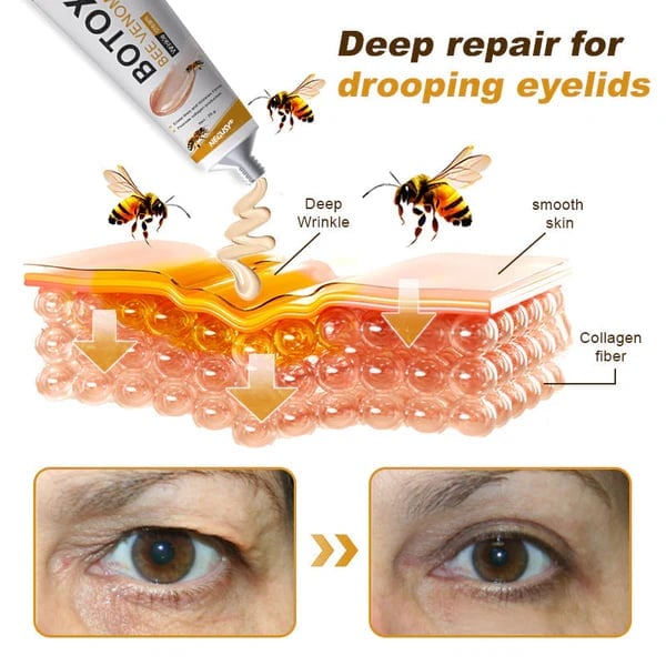 (Made and Shipped from USA) 🧑‍⚕️NEGUSY® Botox Bee Venom Wrinkle Removal Cream