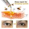 (Made and Shipped from USA) 🧑‍⚕️NEGUSY® Botox Bee Venom Wrinkle Removal Cream