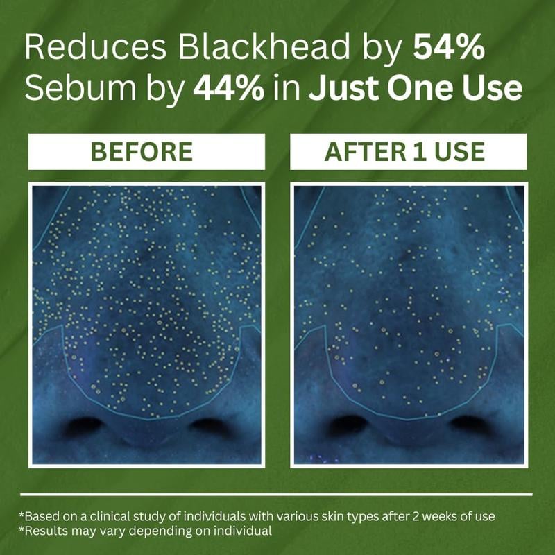 💥LAST DAY SALE 50% OFF💥Bubble Deep Cleansing Mask⚡BUY 3 GET 2 FREE