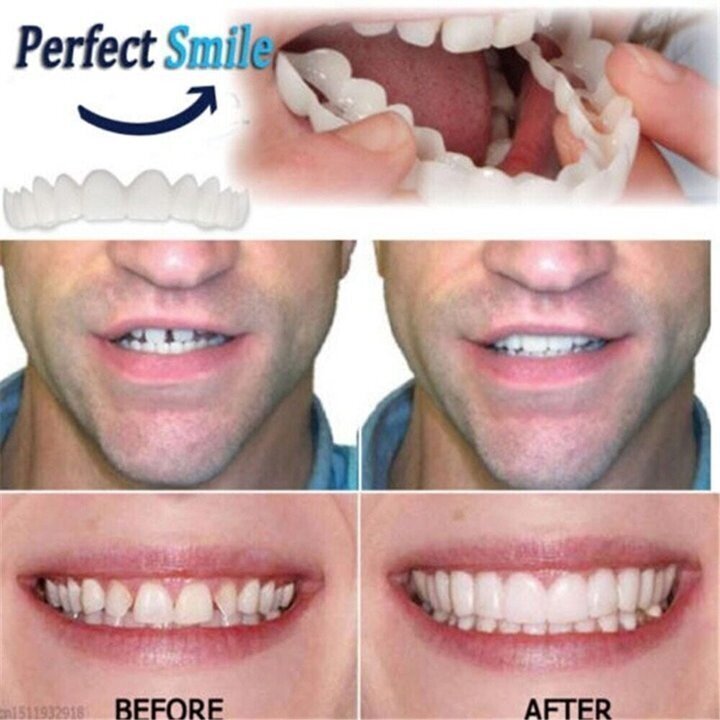 💝Last day discount-75%Off💝Latest👨‍⚕Adjustable Snap-On Dentures😁