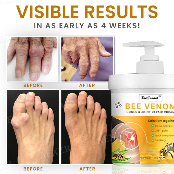 💥LAST DAY SALE 50% OFF💥Bee Venom Bones & Joint Repair Cream