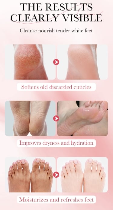 🔥Last Day Promotion 50% OFF💥Niacinamide Foot Mask Rejuvenating Flower and Fruit Essence