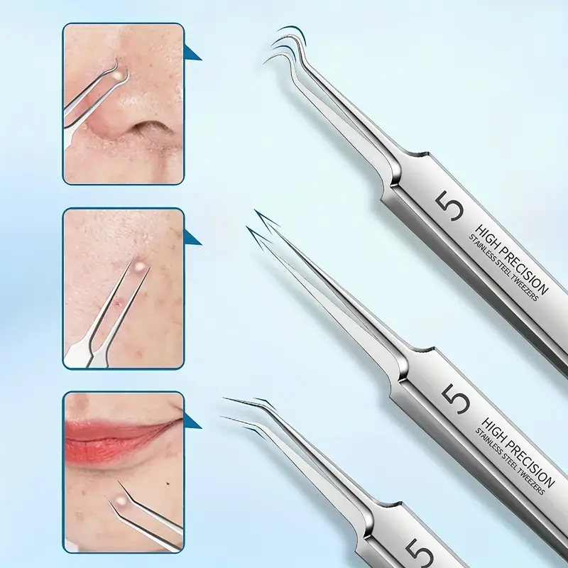 💥LAST DAY SALE 50% OFF💥Professional Facial Blackhead Remover Tweezers