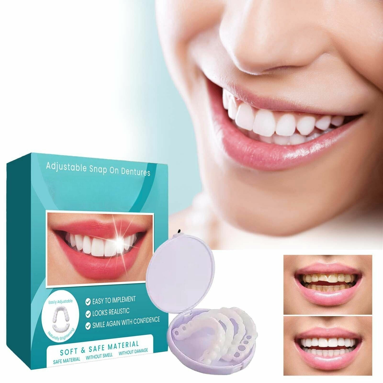 💝Last day discount-75%Off💝Latest👨‍⚕Adjustable Snap-On Dentures😁