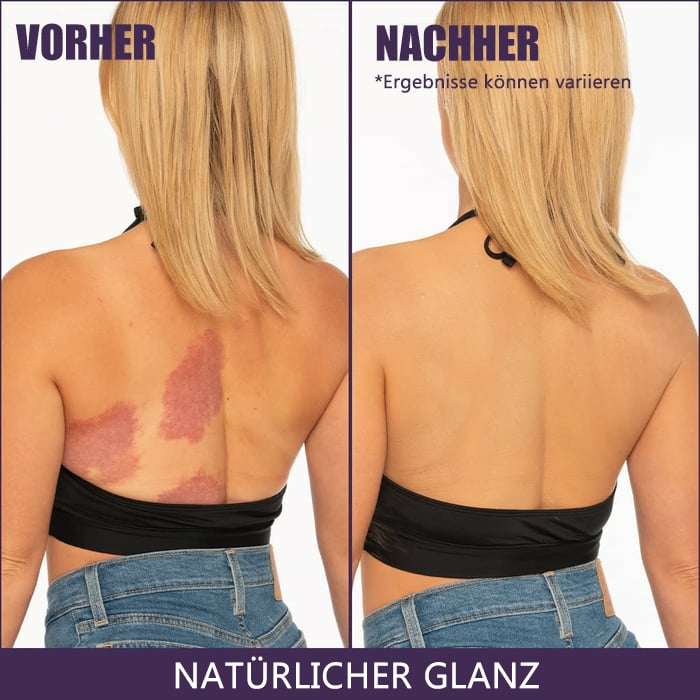 🎉Letzter Tag 49 % Rabatt🎁Perfektionierer für den gesamten Teint