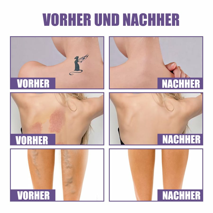 🔥Letzter Tag 50% RABATT-Perfekter Hautton-Concealer