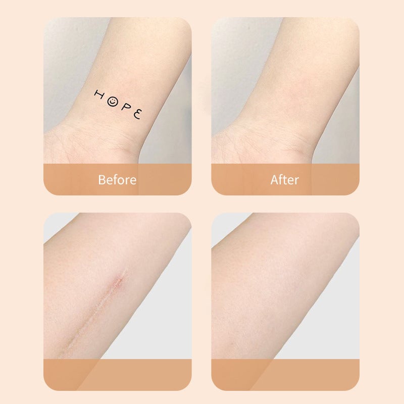 🔥Last day to get 49% off🔥Ultra-Thin Tattoo and Scar Concealer Patch-👍1 SET OF 6PCS