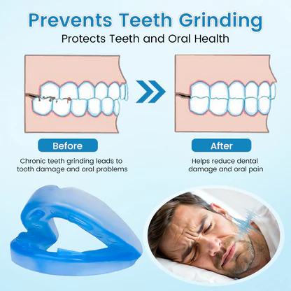 LAST DAY SALE 60% OFF⏰ PerfectSleep Solution- Anti-Snoring & Anti-Grinding Teeth Protector