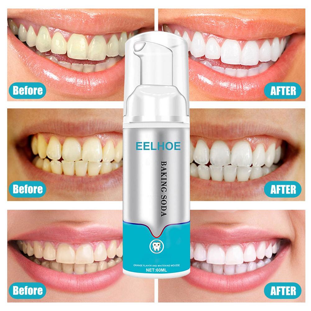 ✨Limited Time Sale - 49% OFF✨Instant Tooth Whitener