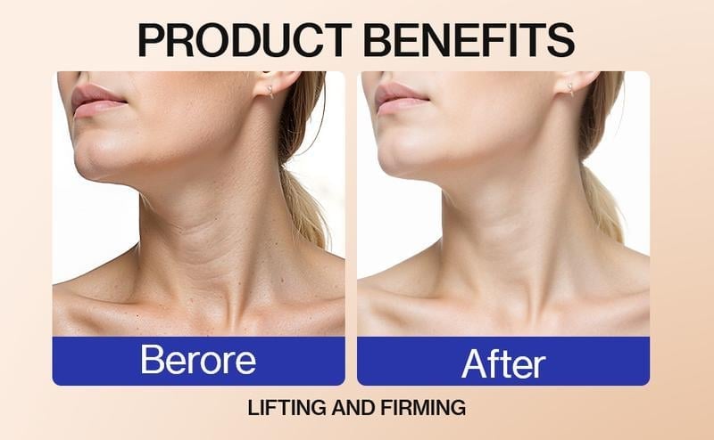💕Hot sale 49% OFF💖Neck Firming Cream, Tighten and Lift Neck Cream for Crepey Skin