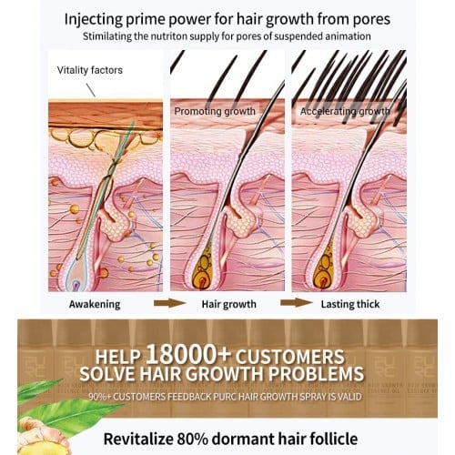 💥2023 New Hair Growth Spray - Fast Hair Growth - Prevent Hair Loss[🔥Buy 1 Get 1 Free🔥]